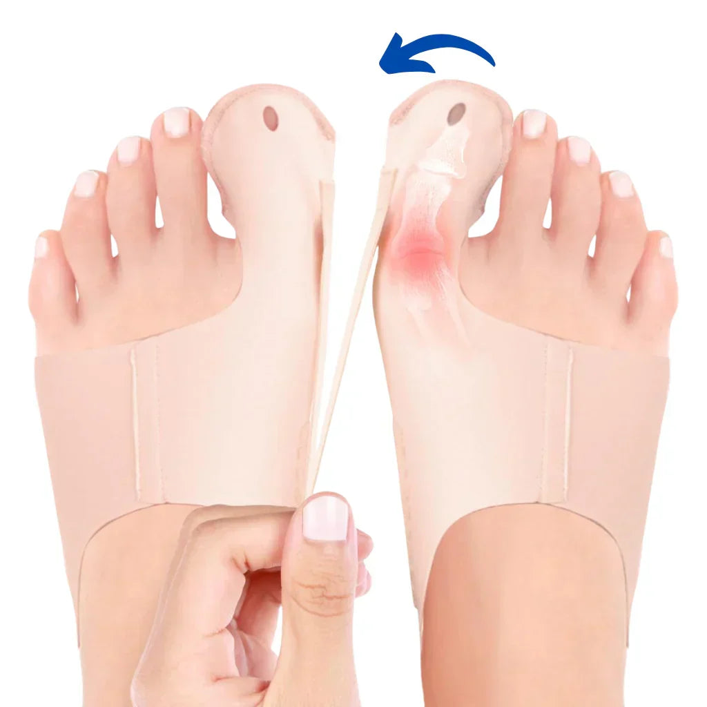1+1 GRATIS | Hallux Valgus™ | Din bekväma lösning för smärtfria fötter!
