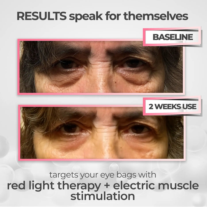 LumaNova Eye Rejuvenator för rödljusterapi och mikroströmsbehandling