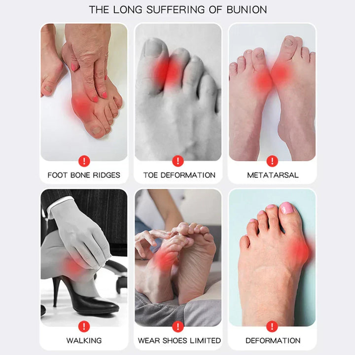 1+1 GRATIS | Hallux Valgus™ | Din bekväma lösning för smärtfria fötter!