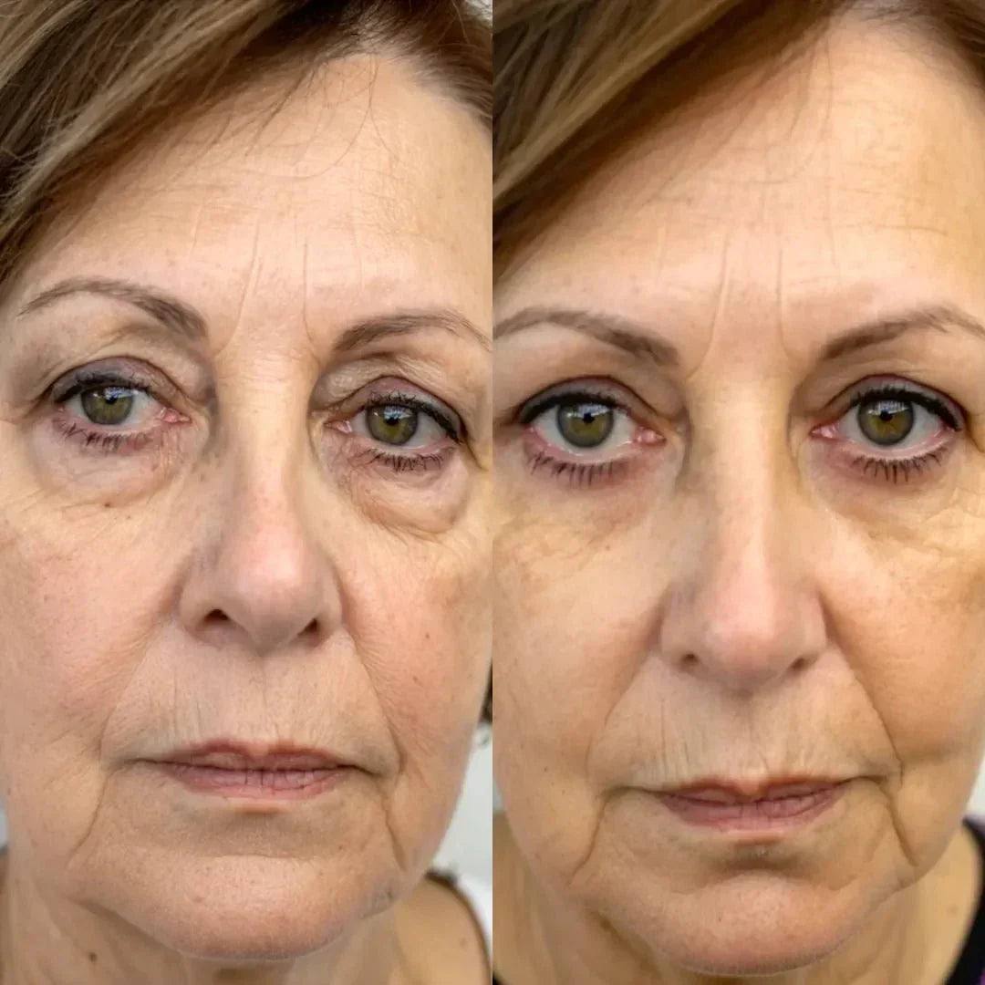 LumaNova Eye Rejuvenator för rödljusterapi och mikroströmsbehandling