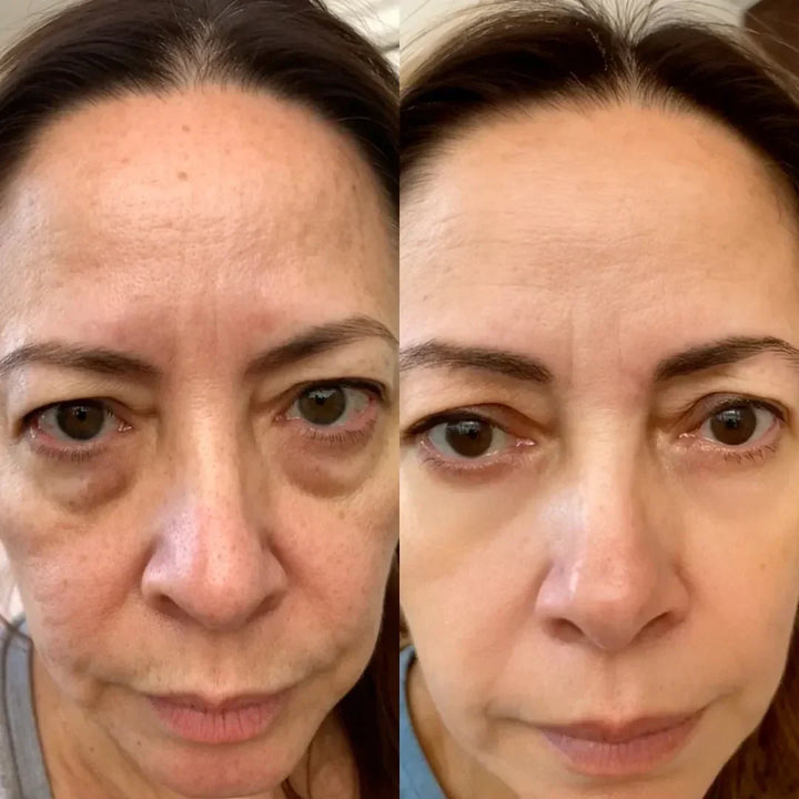 LumaNova Eye Rejuvenator för rödljusterapi och mikroströmsbehandling