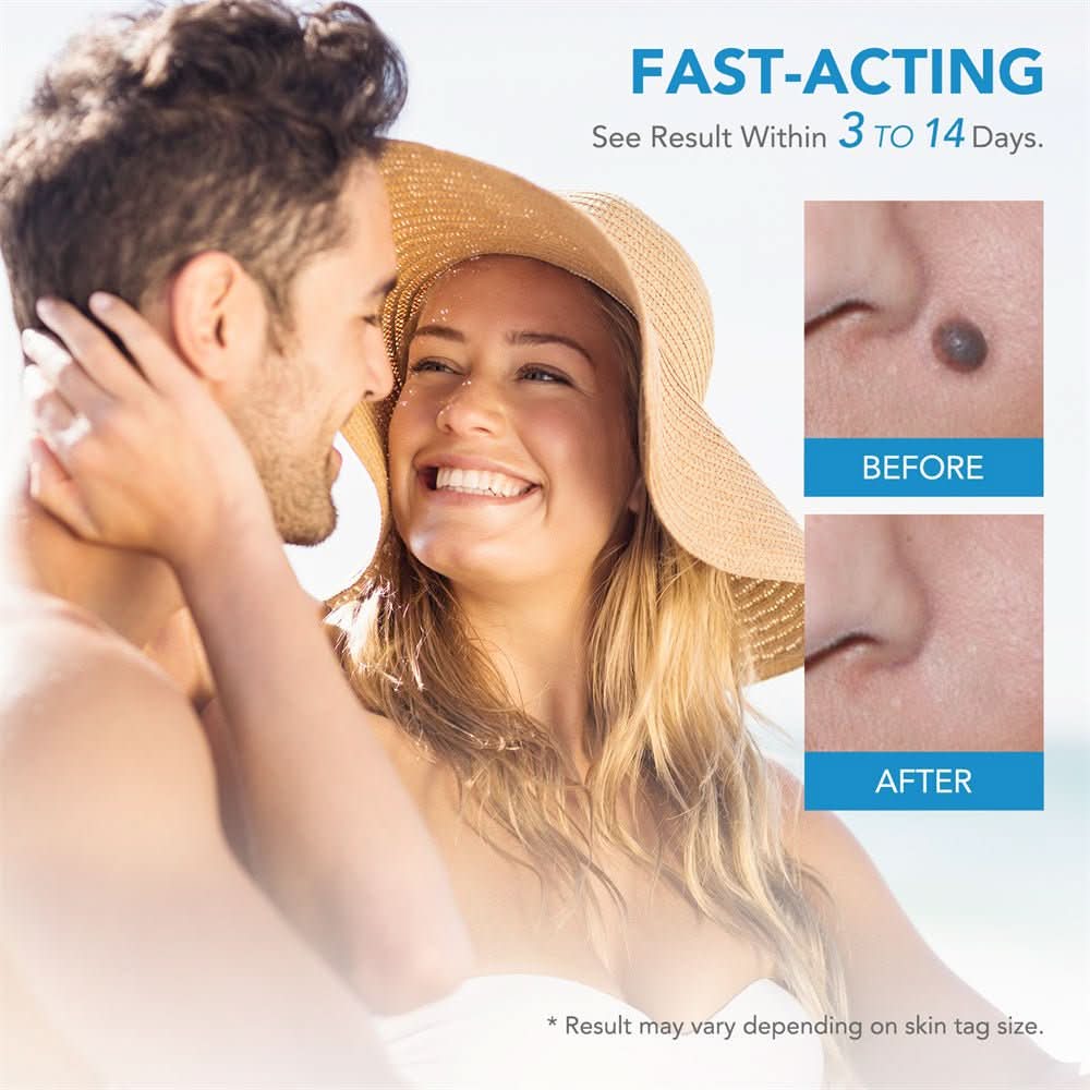 Dermaswift – Ta bort hudfläckar mot vårtor och hudutväxter