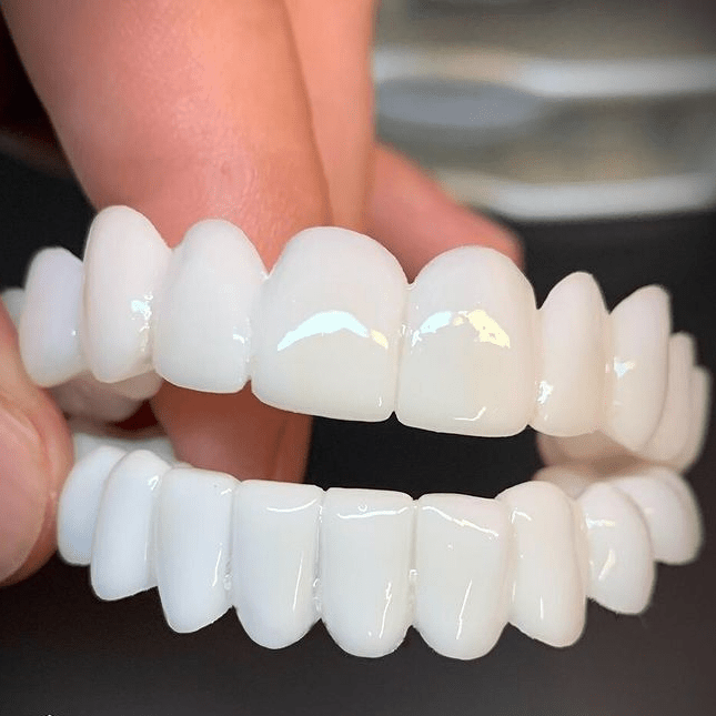 SmileFlex – Anpassningsbar Tandprotes med Tandlinser