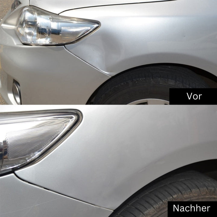 Verktyg för att ta bort bucklor | Ta bort bucklor och märken från bilen | DellenMeister