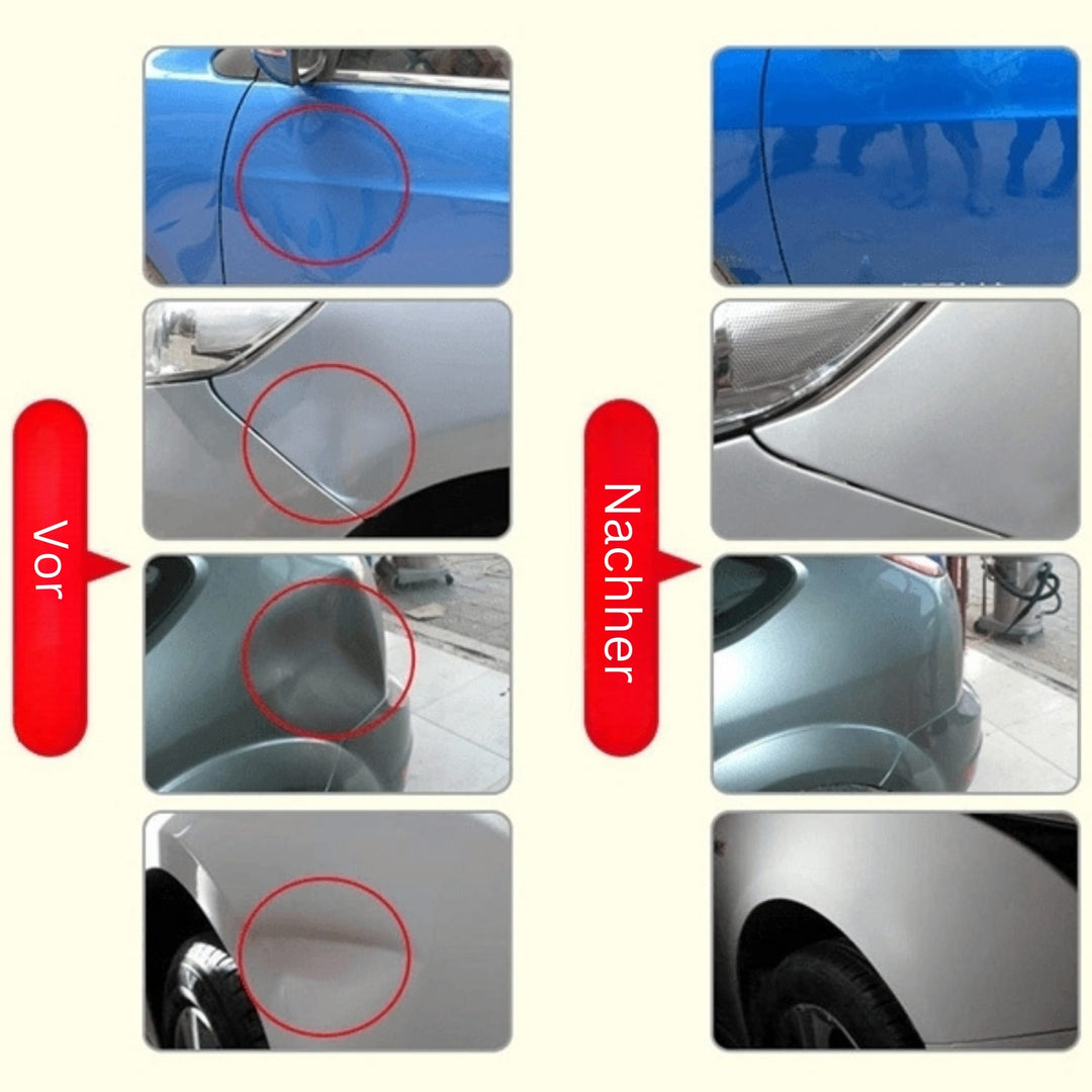 Verktyg för att ta bort bucklor | Ta bort bucklor och märken från bilen | DellenMeister