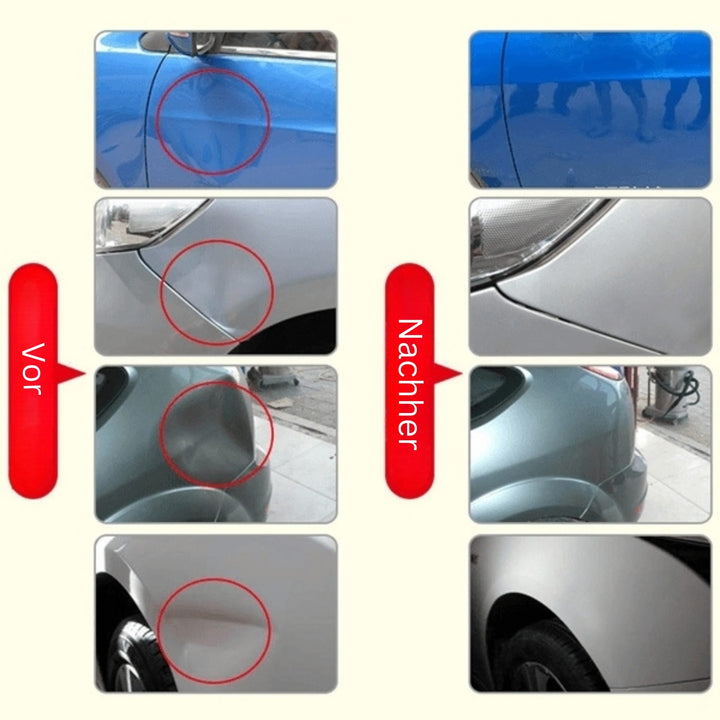 Verktyg för att ta bort bucklor | Ta bort bucklor och märken från bilen | DellenMeister